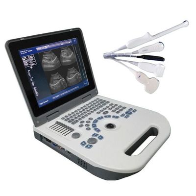 Kalite  TGC Control Notebook Ultrasound Scanner For Pregnancy Home Use fabrika