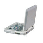 15 İnç LED Renkli Taşınabilir Ultrason Cihazı, 60 Derece Tarama Açısı ve ≥250mm Derinlik Ekranı