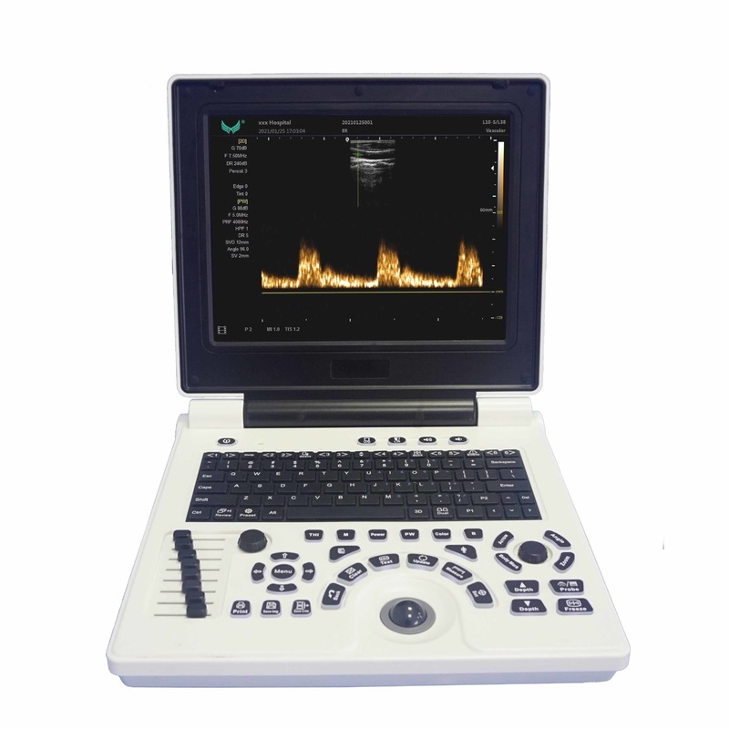 Gebelikte OB GYN Taşınabilir Renkli Doppler Ultrason Makinesi