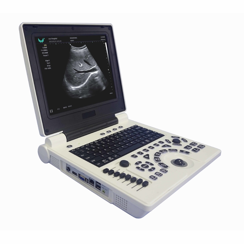 Gebelikte OB GYN Taşınabilir Renkli Doppler Ultrason Makinesi