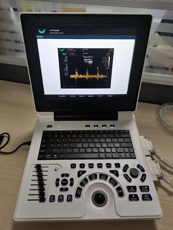 Xianfeng Gebelik Renkli Doppler Ultrason Makineleri Görüntüleri 4B OEM
