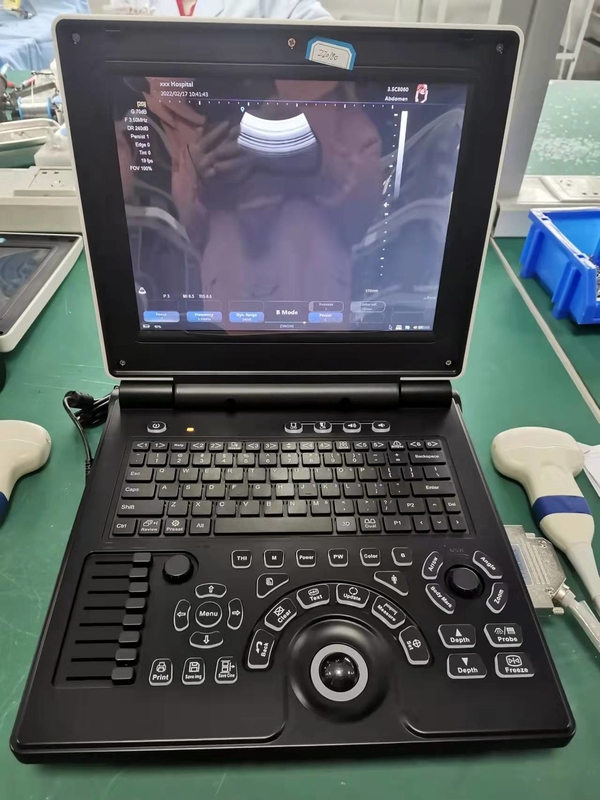 ISO Temel Seviye Taşınabilir USG Makinesi Dijital Renkli Doppler Ultrason Sistemi