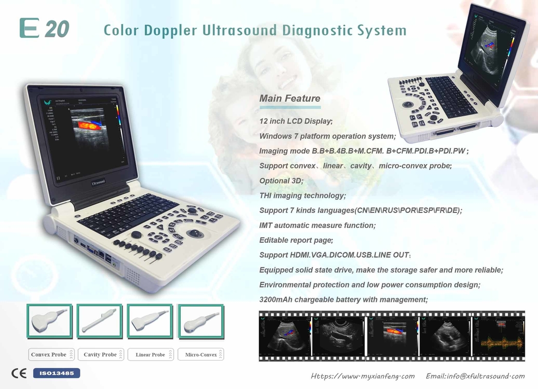 ISO Temel Seviye Taşınabilir USG Makinesi Dijital Renkli Doppler Ultrason Sistemi