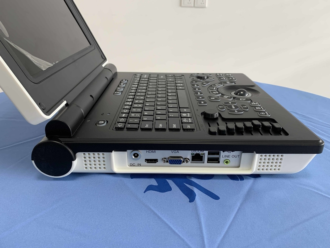 ISO Temel Seviye Taşınabilir USG Makinesi Dijital Renkli Doppler Ultrason Sistemi
