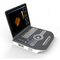 Eko Tıbbi 4D Renkli Taşınabilir Ultrasonografi Makinesi Ultrason Dijital