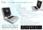 OEM Hastane Ultrasonik Teşhis Aleti 120GB Ultrason Tıbbi Ekipman