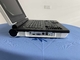 OEM Hastane Ultrasonik Teşhis Aleti 120GB Ultrason Tıbbi Ekipman