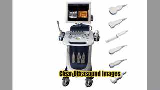 Doppler Ultrason Tarayıcı PW CFM PDI Modu