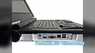 Taşınabilir Ultrason E20 Klinik Hastane