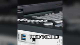 Taşınabilir 4D Doppler Ultrason Makinesi Yoğun Bakım Ünitesine Hazır