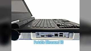 Taşınabilir Renkli Doppler Ultrason E0 Üroloji Taraması